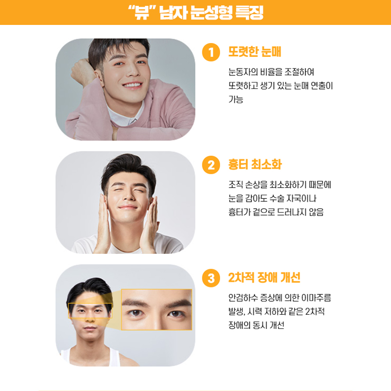 남자눈매교정 개인 상황에 맞춰 뷰에서 관련 이미지 6