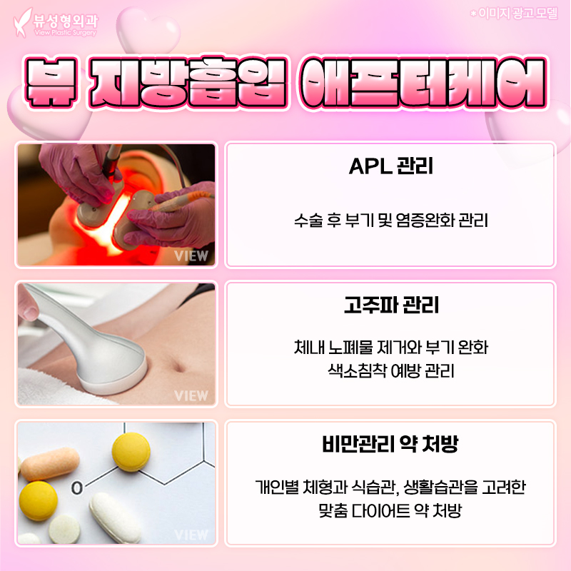 단기간내 눈에 띄는 지방 감량 방법, 지방흡입 관련 이미지 6