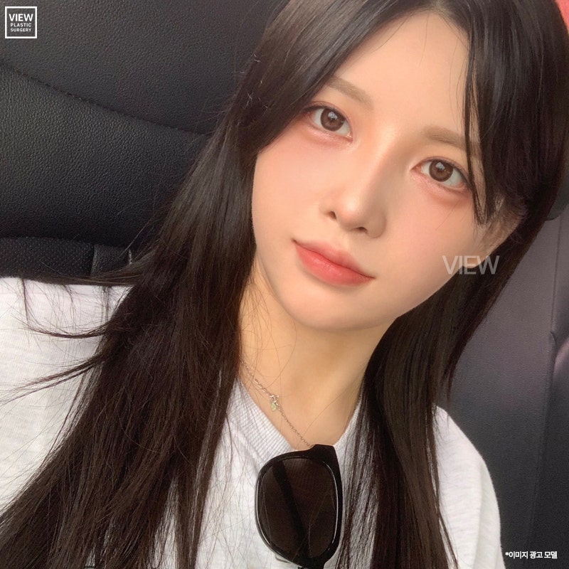 눈성형 후 관리법✨ 깔끔하게 요약해드릴게요! 관련 이미지 3