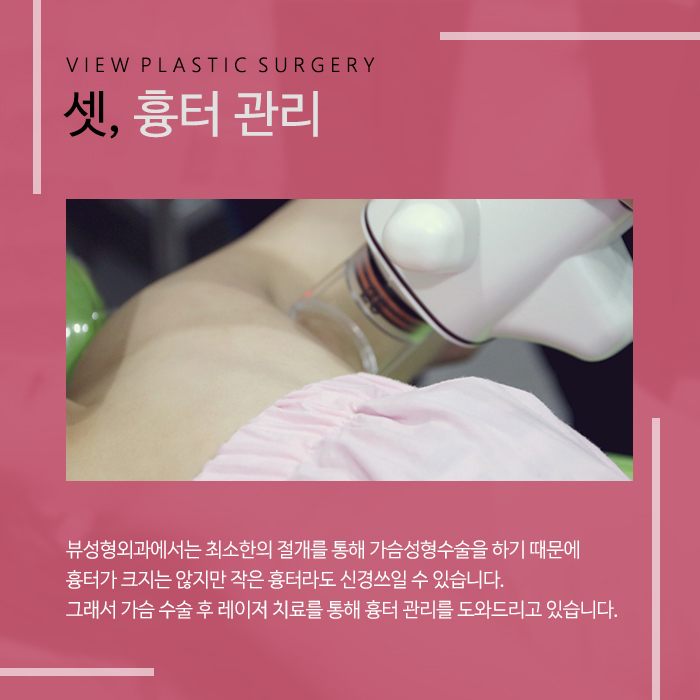 뷰의 가슴사후관리 토탈시스템 관련 이미지 4