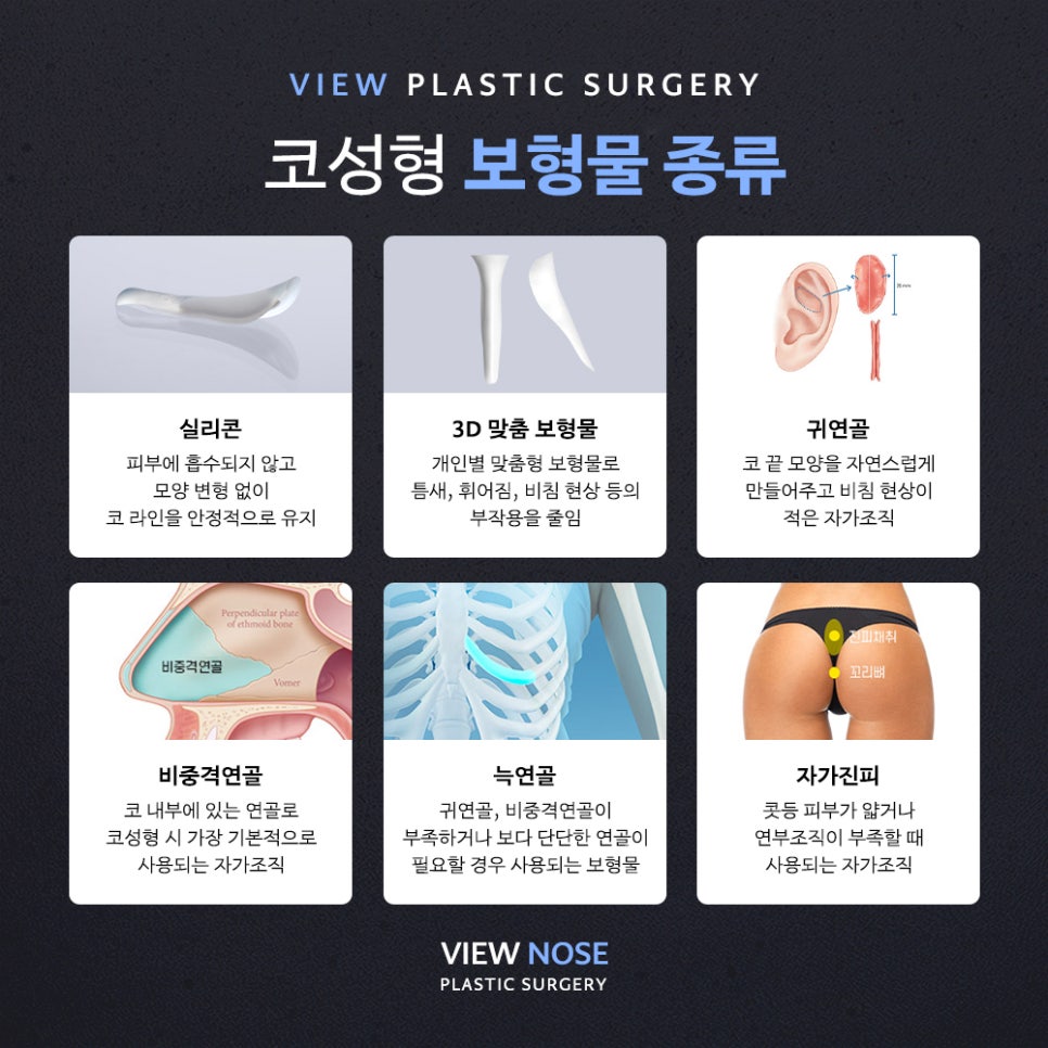 코성형, 개인별 유형에 적합한 수술방법은? 관련 이미지 7