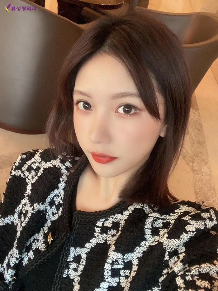 V라인리프팅 타이트하게 실리프팅으로 당겨주자 관련 이미지 1