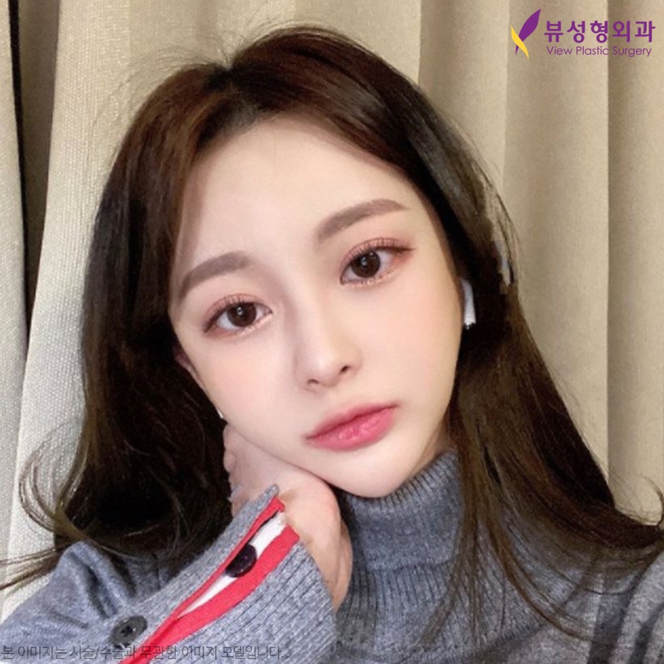 쌍수후기 좋은 눈수술잘하는곳! l 뷰성형외과 관련 이미지 1