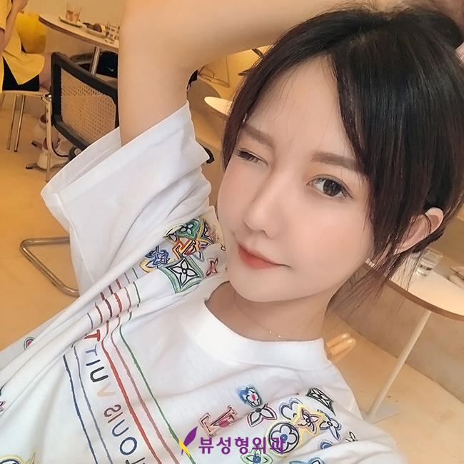 나에게 맞는 윤곽성형은 무엇일까? 관련 이미지 4