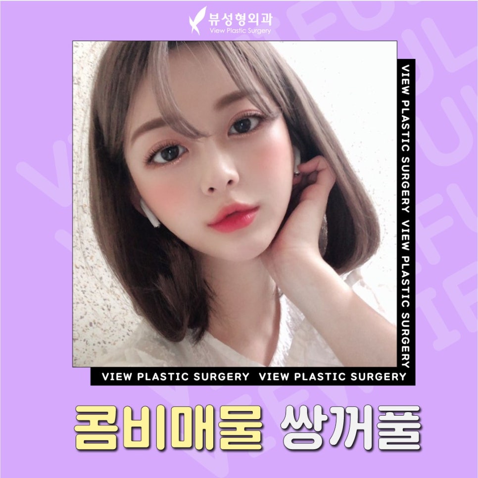 매몰법 잘 하는 곳 찾는다면 뷰 성형외과 관련 이미지 4