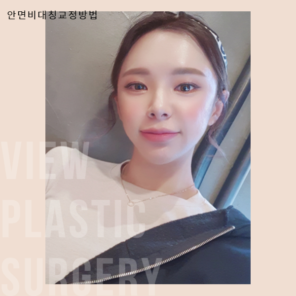 안면비대칭교정방법 자세히 알고 싶다면 관련 이미지 9