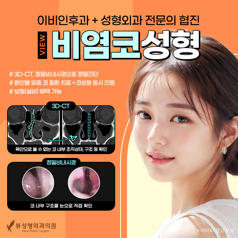 예술적인 코라인부터 비염수술까지 잘하는 뷰성형외과 관련 이미지 2