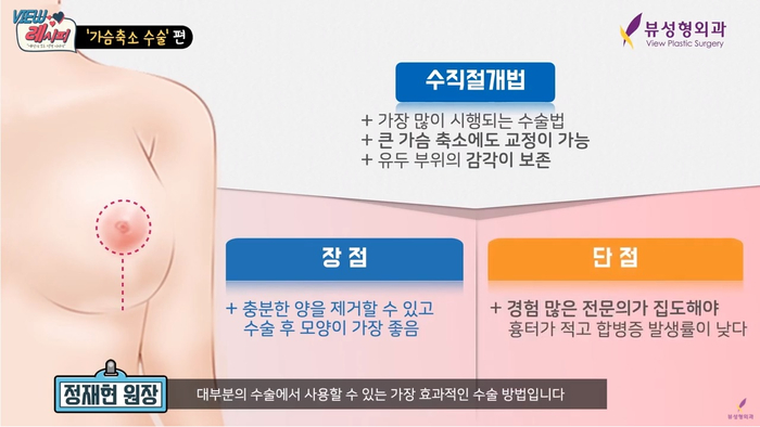 자연스런 가슴성형, 본인에게 적합한 보형물 및 절개방법 선택 중요 관련 이미지 11