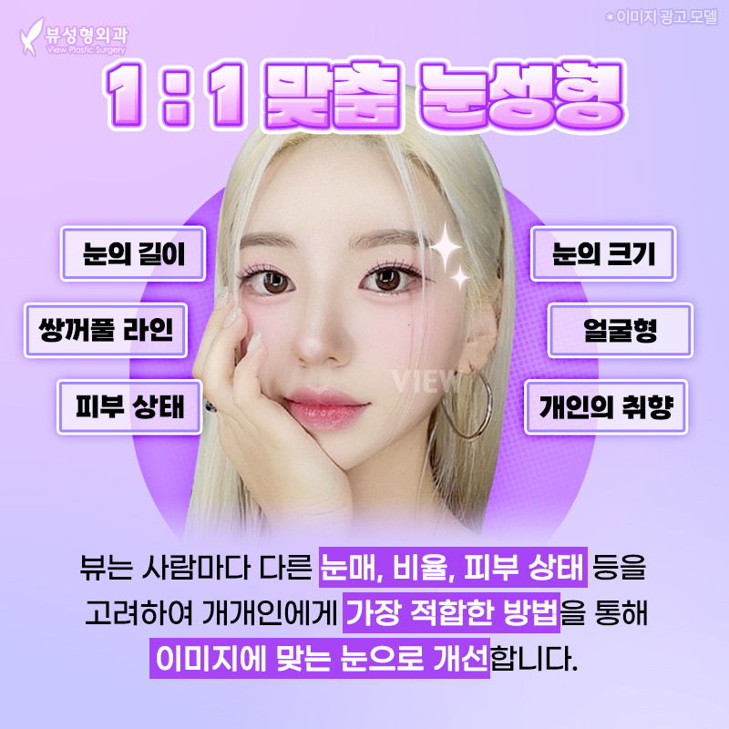 뒷트임밑트임후기로 강아지눈매 자랑해보자고! 관련 이미지 7