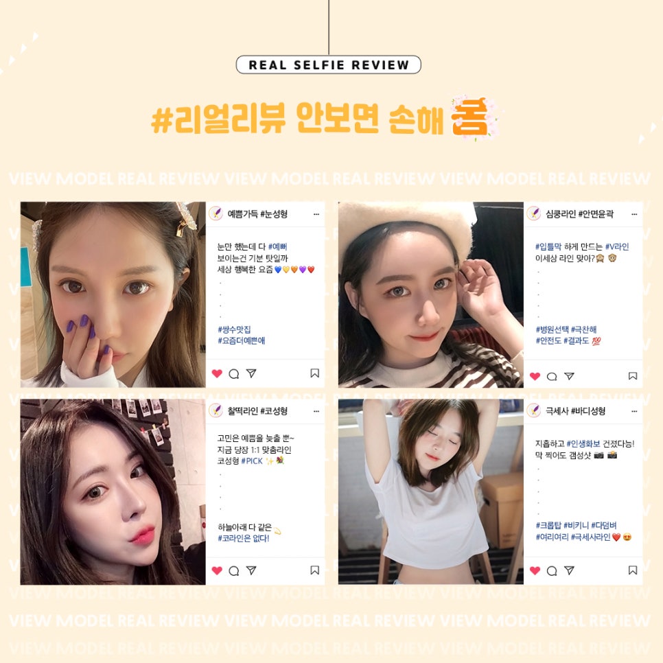 ☆뷰성형외과 3월 프로모션으로 예뻐져봄☆ 관련 이미지 4