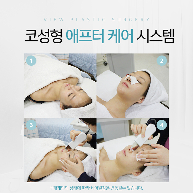 수술 후 관리까지 꼼꼼한 뷰티풀 코성형 관련 이미지 6