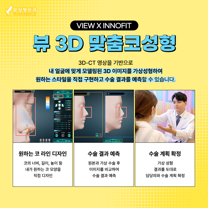 코성형 전, 콧구멍을 봐야 하는 이유? 관련 이미지 1