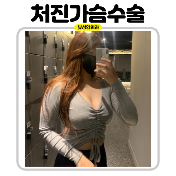 처진가슴수술 종류가 궁금하다면 관련 이미지 9