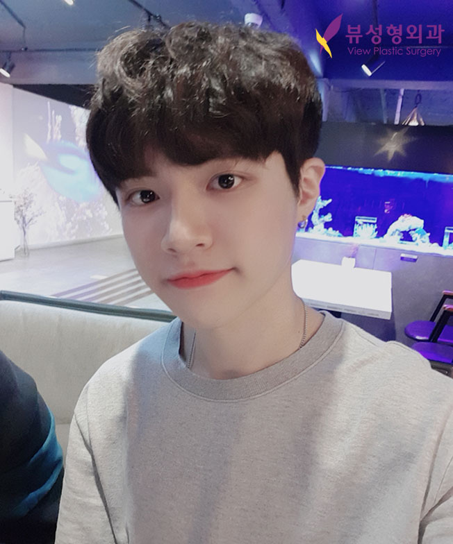 긴얼굴성형 미용과 기능 모두 잡길 원한다면 관련 이미지 9