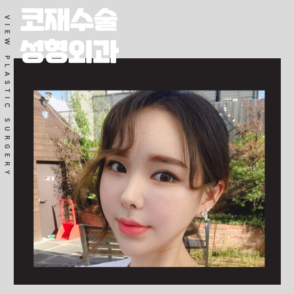 코재수술성형외과 찾고있다면 뷰성형외과로 관련 이미지 4
