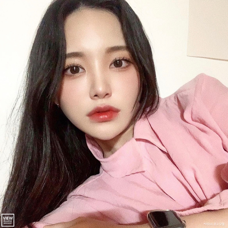 트임수술 I 보정 어플 속 눈매를 내 눈에 SSG- 관련 이미지 1