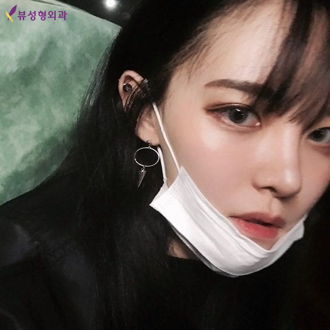 믿고보는 뷰성형외과 코성형후기★ 관련 이미지 2