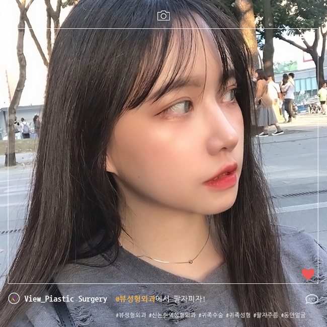 팔자주름 더이상 고민하지 마세요! 관련 이미지 4