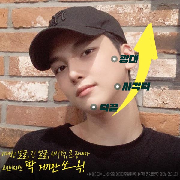 남자안면윤곽수술 의 핵심은! 관련 이미지 2