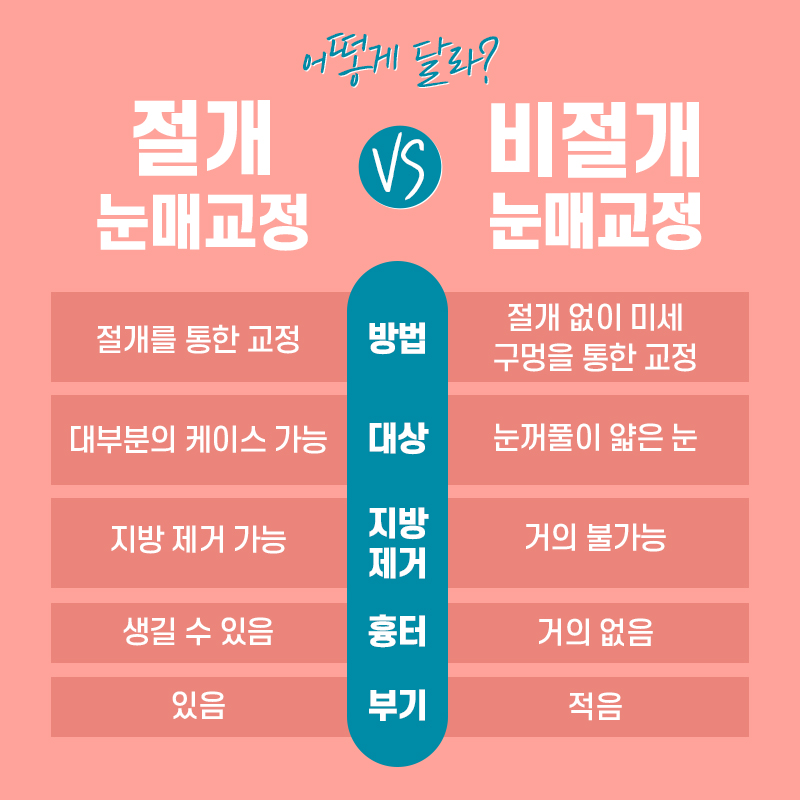 눈성형외과 중요한 점부터 관련 이미지 4