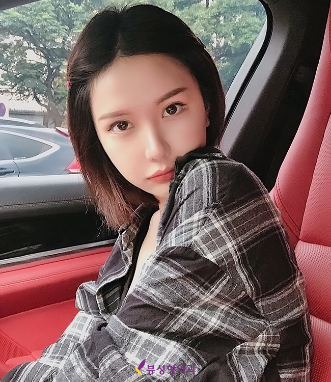 눈매교정수술전후 차이를 더 또렷하게 관련 이미지 7