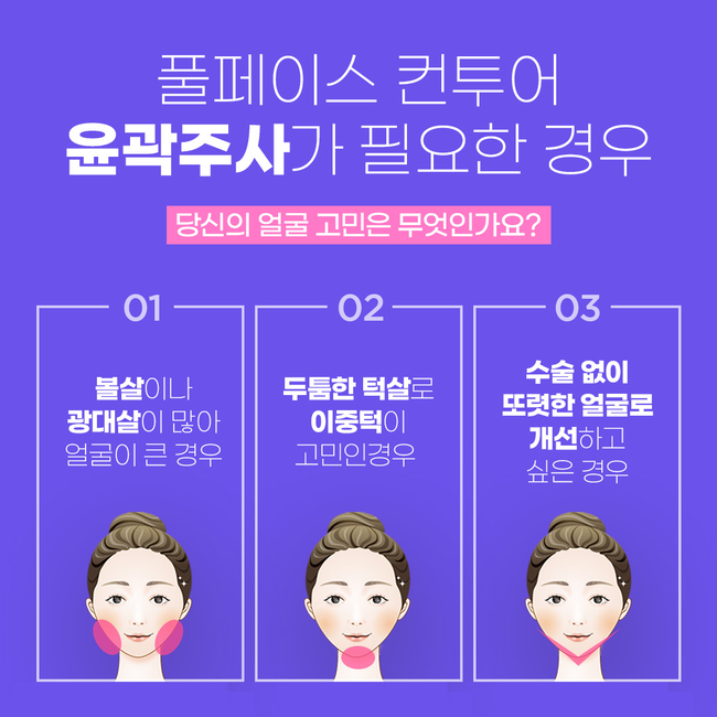 윤곽주사 후기 갸름하게 변화된 비결은 뷰성형외과 관련 이미지 5