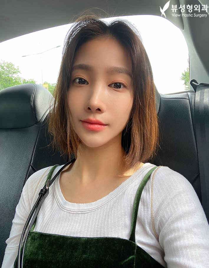 긴얼굴성형 미용과 기능 모두 잡길 원한다면 관련 이미지 4