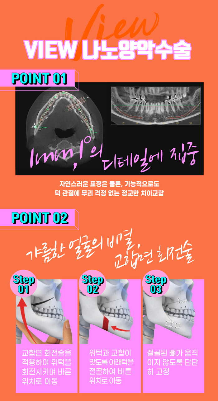 예뻐지는 수술? 양악수술의 올바른 정보 관련 이미지 7