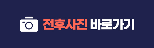 실리프팅 VS 안면거상술, 피부 상태에 맞는 맞춤리프팅 관련 이미지 12