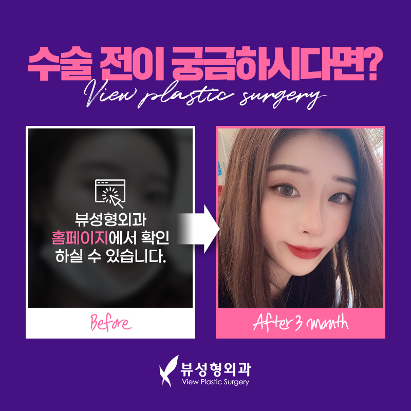 코재수술후기 꼼꼼하게 따져 보아야 할 점은 관련 이미지 6