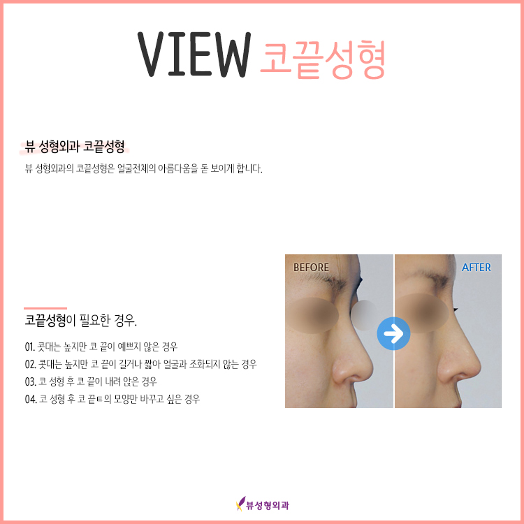 완벽한 코라인의 완성 코끝성형! 관련 이미지 3
