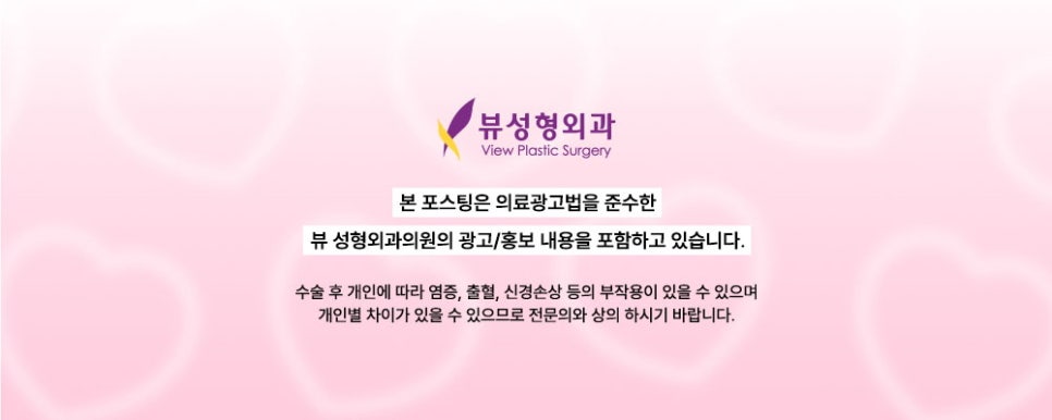 내게 맞는 눈성형 알아보기 관련 이미지 18