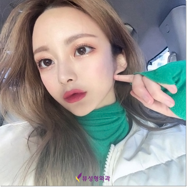 눈밑지방재배치로 인상이 확 달라졌어요.&hearts; 관련 이미지 8