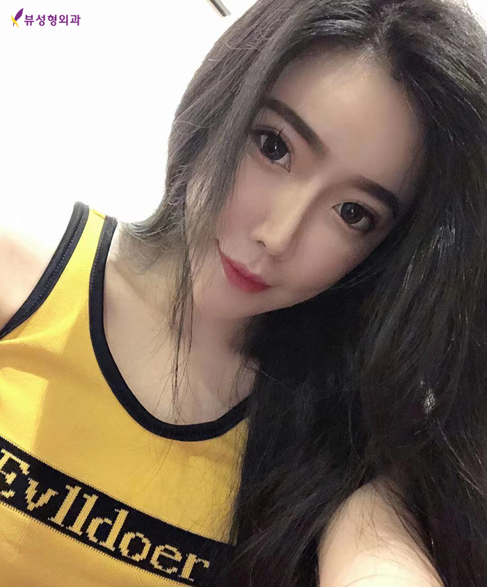 V라인리프팅 타이트하게 실리프팅으로 당겨주자 관련 이미지 5