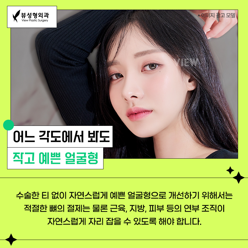 얼굴형의 밸런스를 맞춰주는 안면윤곽수술 관련 이미지 3