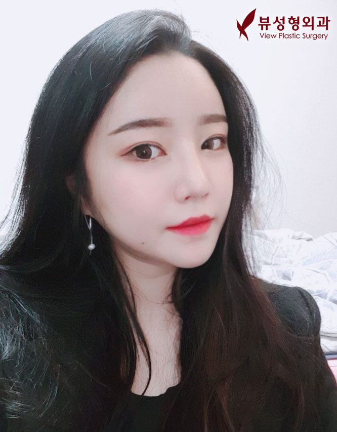 쌍꺼풀수술잘하는병원 알아보고 있다면 관련 이미지 8