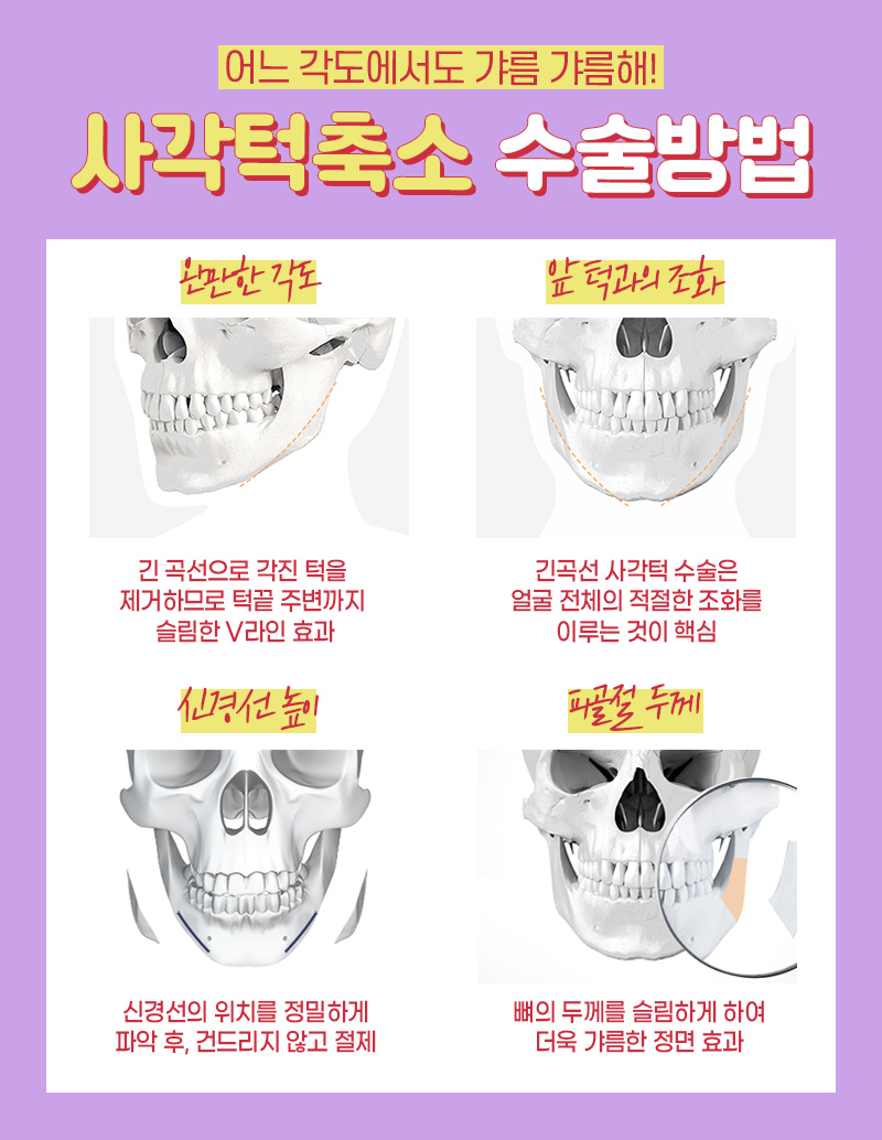 안면윤곽비용 걱정하기 보다는 관련 이미지 6