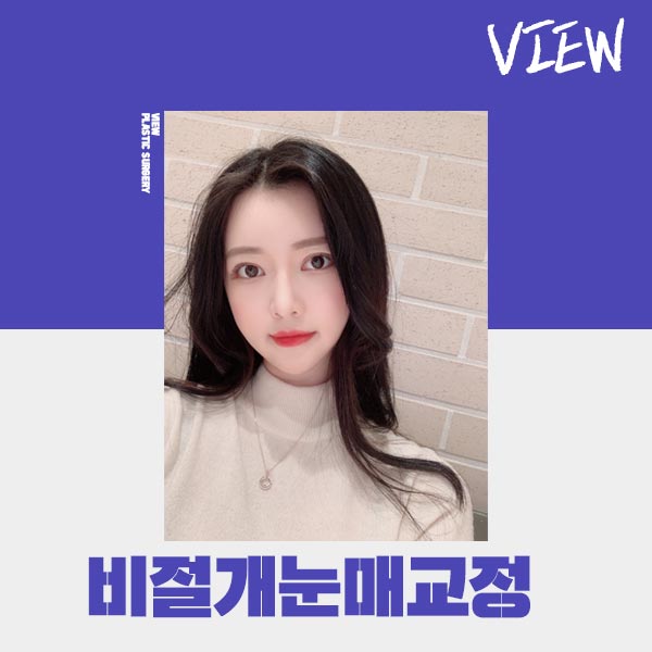 조화로운 비절개눈매교정 하고 싶다면 관련 이미지 1