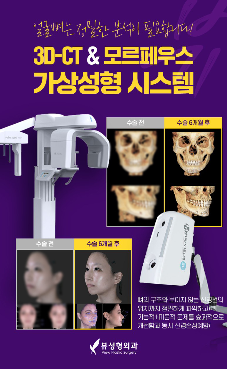 남자안면윤곽수술 개성을 살려서 관련 이미지 5