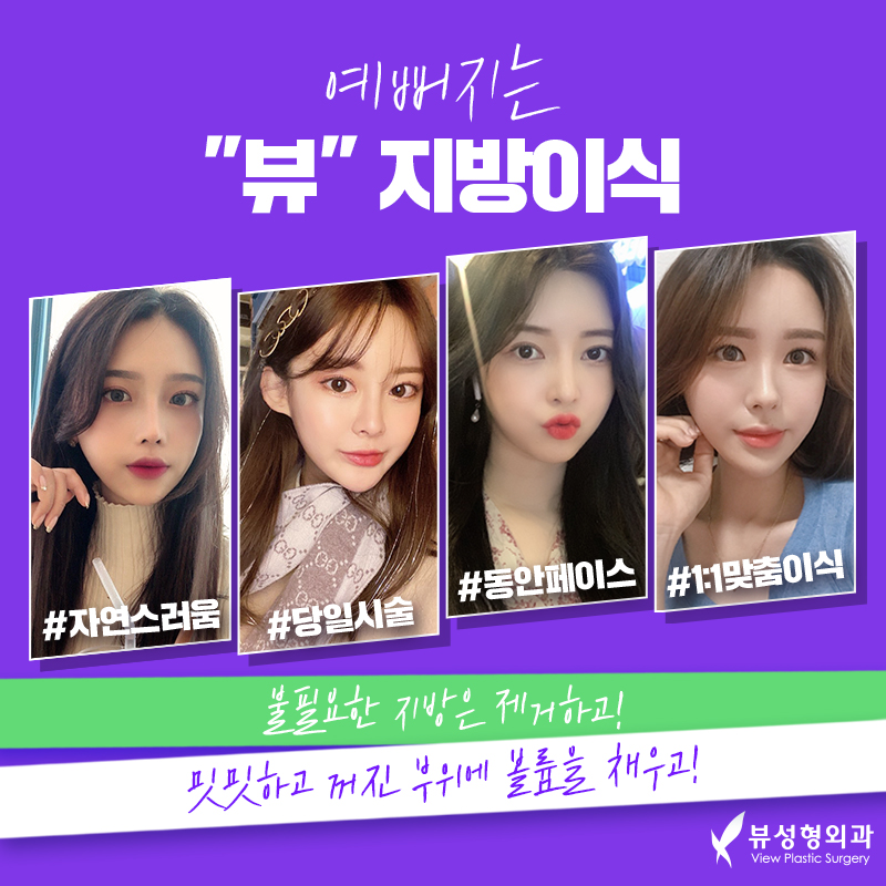 밋밋한 얼굴을 볼륨감 있게 입체적으로 개선하는 지방이식 관련 이미지 12