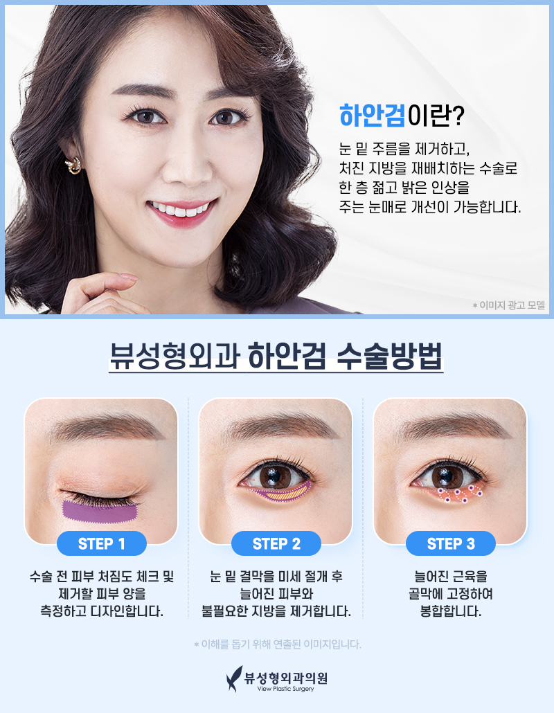 처지고 주름진 피부를 개선하는 동안성형 관련 이미지 7