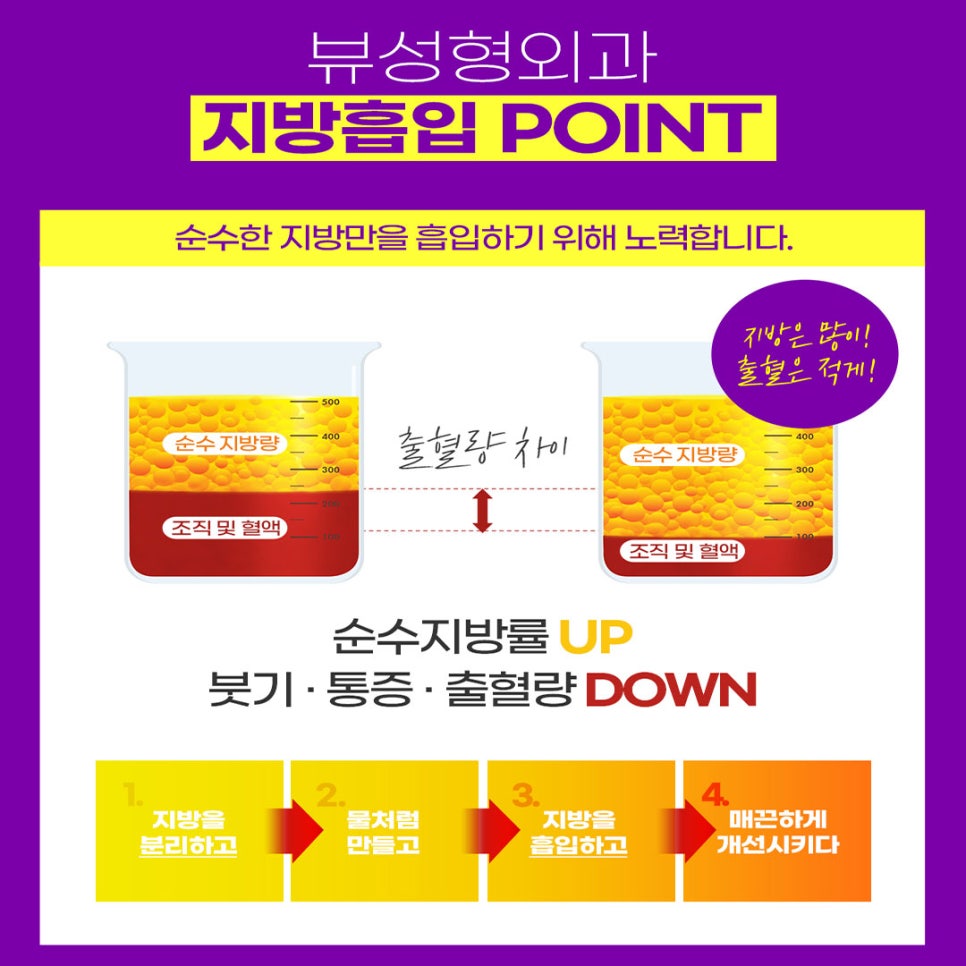 여자다이어트 스트레스 그만! +전후사진 관련 이미지 5