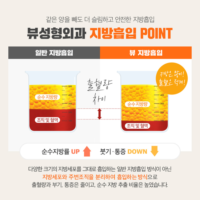 유튜버 박소금이 PICK한, 뷰성형외과 지방흡입 관련 이미지 3