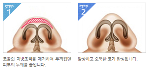 얼굴의 비율과 균형, 조화를 이루는 코성형 관련 이미지 8