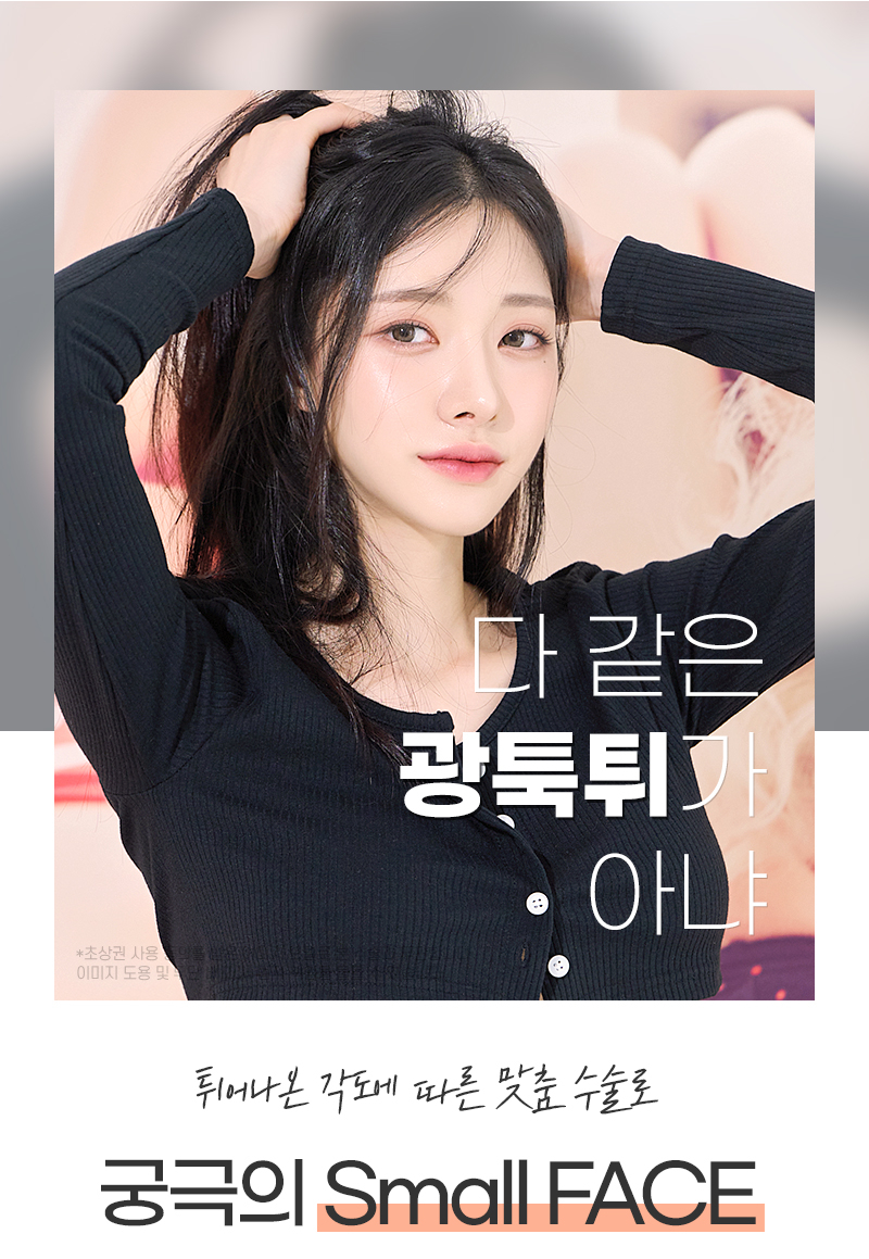 광대축소 하기전에 필수로 알아야 할 것은? 관련 이미지 3