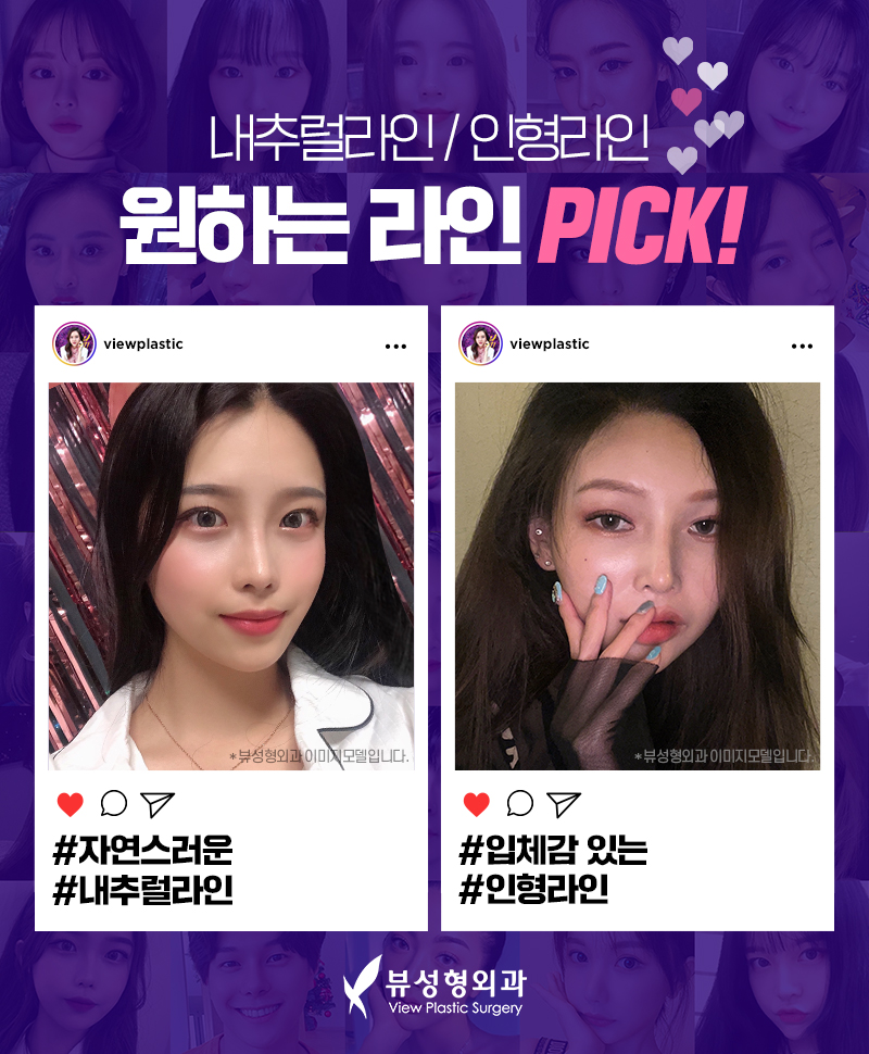 코성형, 개인별 유형에 적합한 수술방법은? 관련 이미지 9