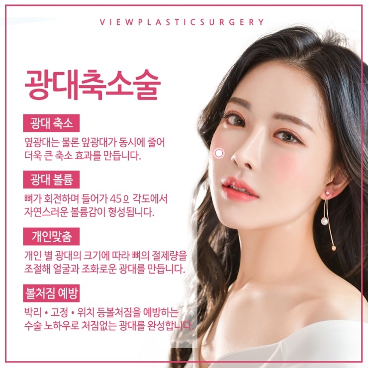 광대축소술 눈치없는 광대 쏙-지워볼까요? 관련 이미지 6