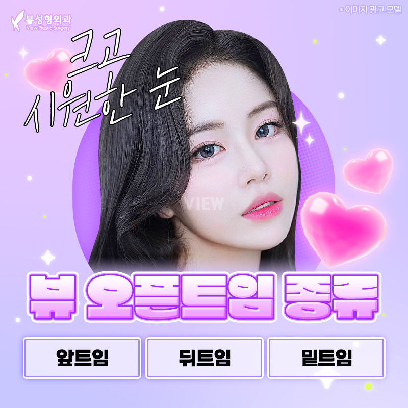 뒷트임밑트임후기로 강아지눈매 자랑해보자고! 관련 이미지 3