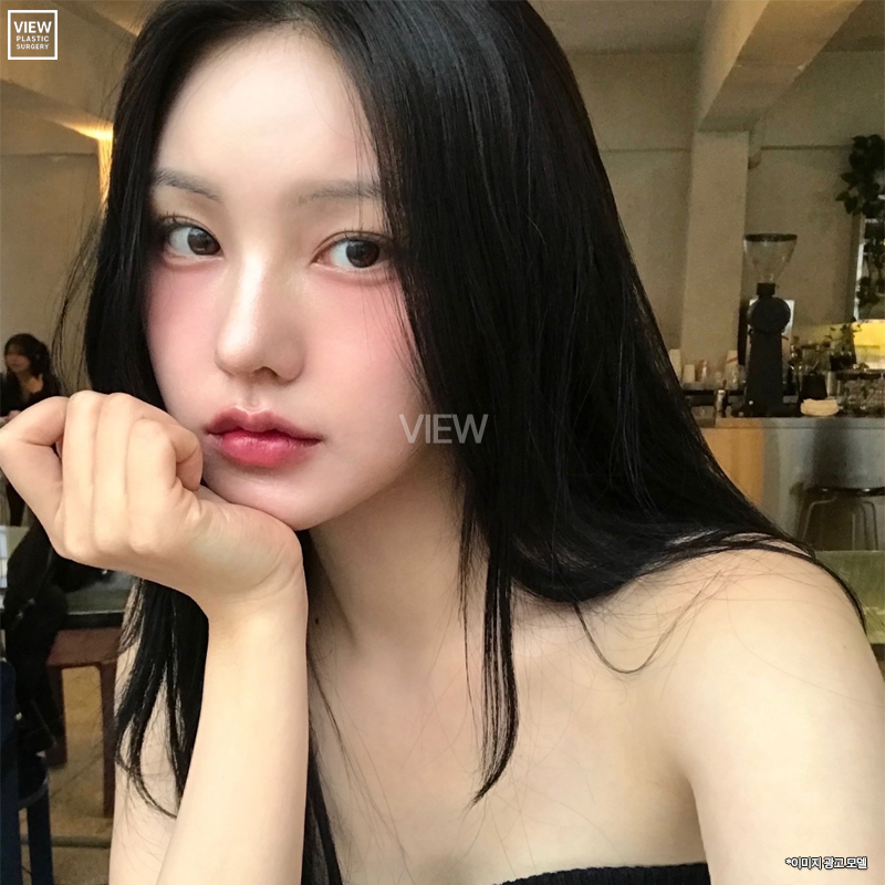 소시지눈 or 단순 부기 어떻게 구별하나요? 관련 이미지 4