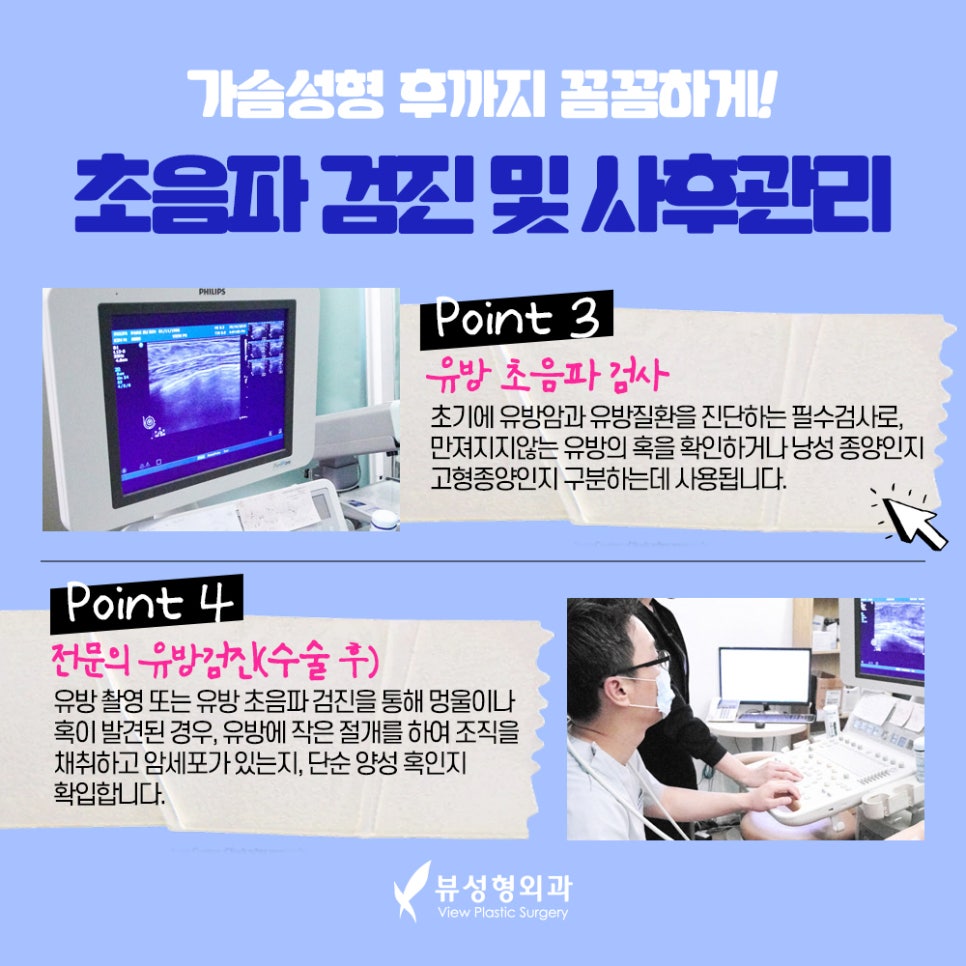가슴확대수술, 효율성까지 따져서 관련 이미지 7